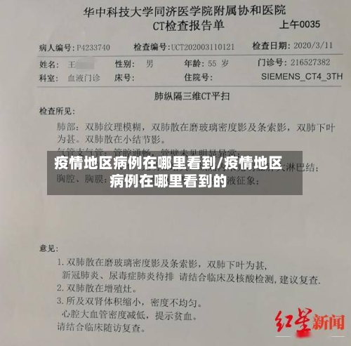 疫情地区病例在哪里看到/疫情地区病例在哪里看到的-第2张图片